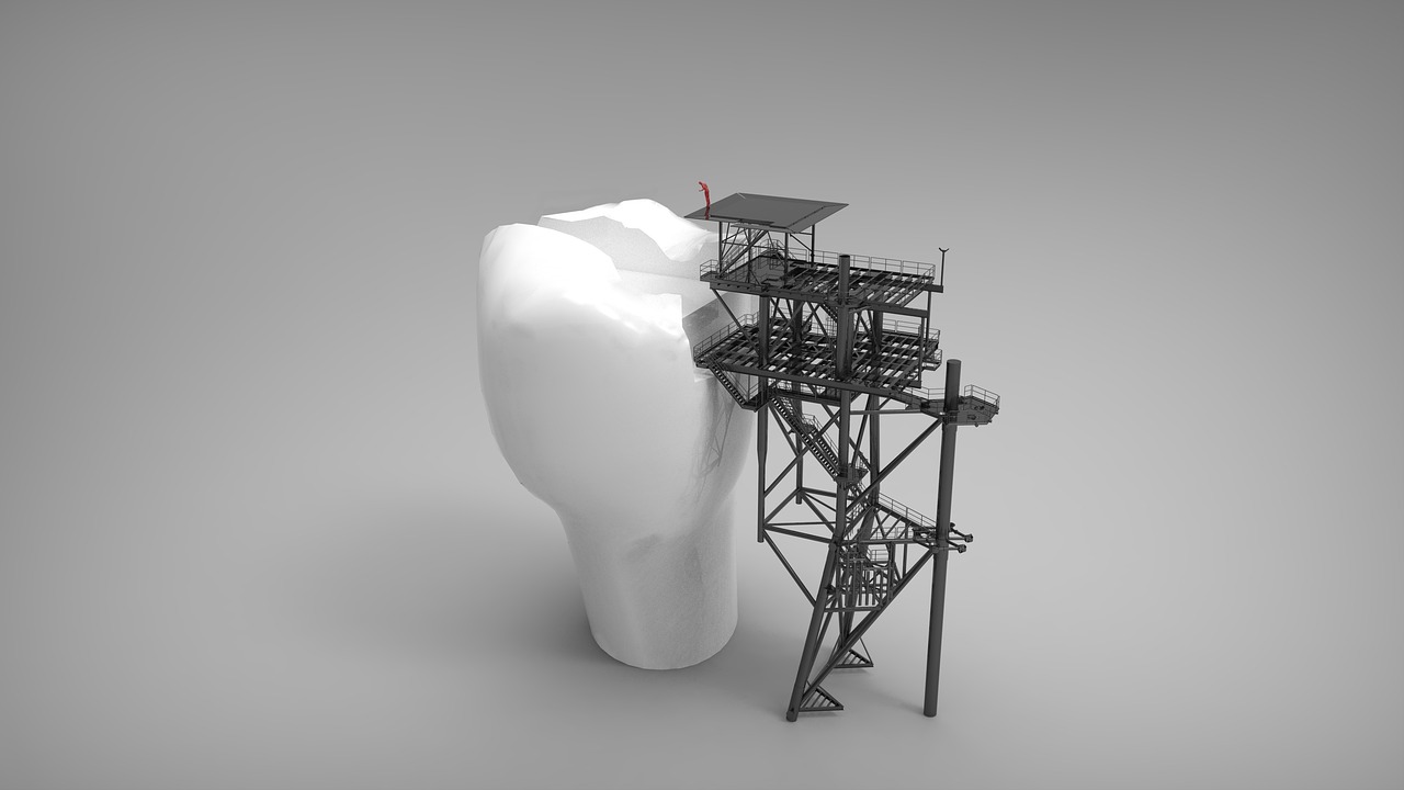 platform, building, tooth-2877646.jpg